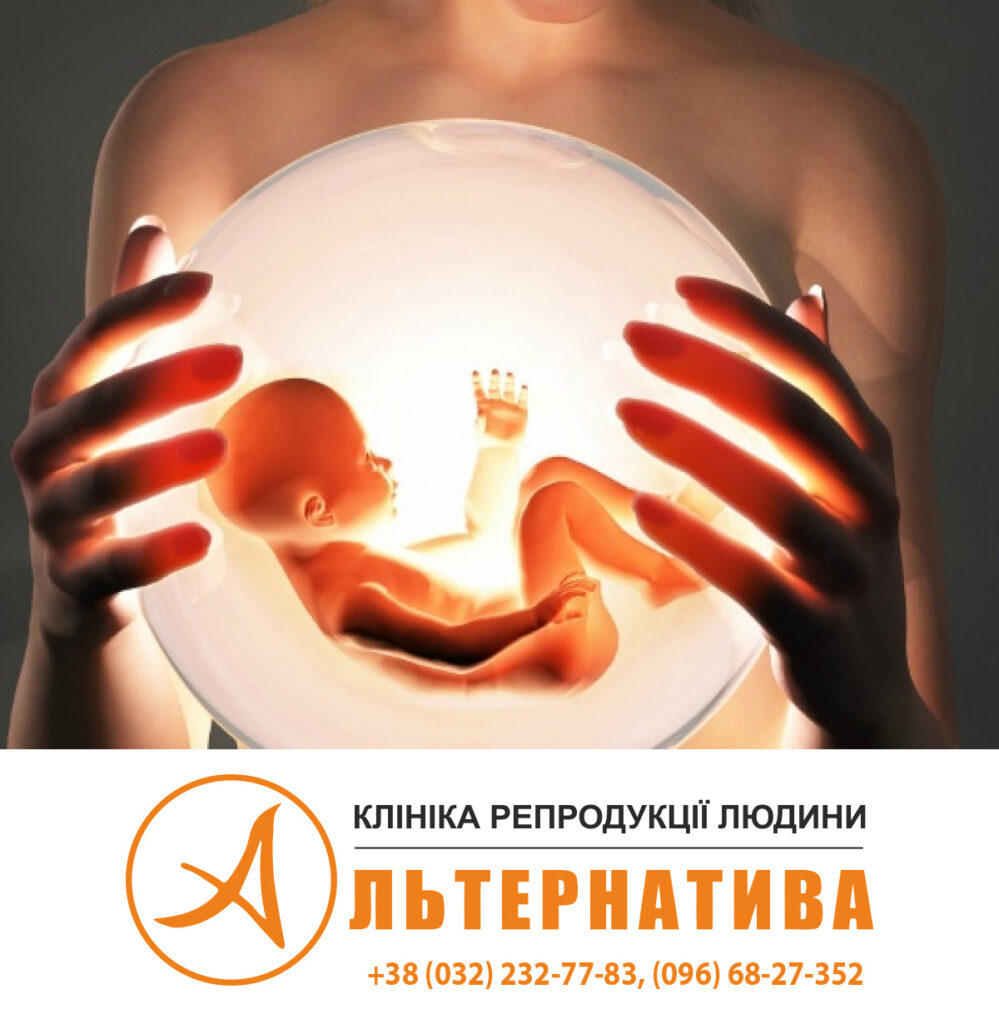 Альтернативний Вибір